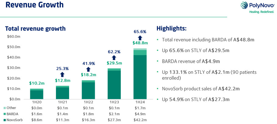 PNV earnings and outlook